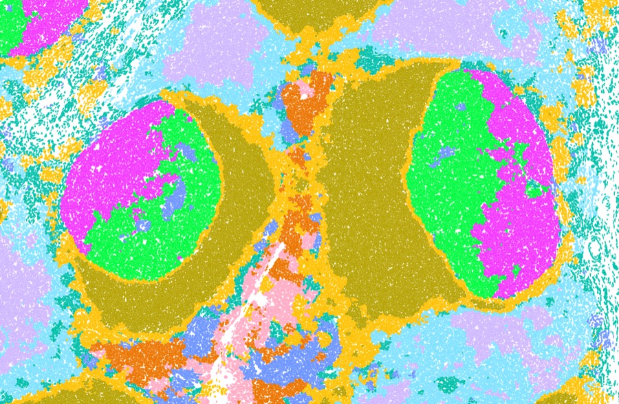 Multichannel image of marker expression